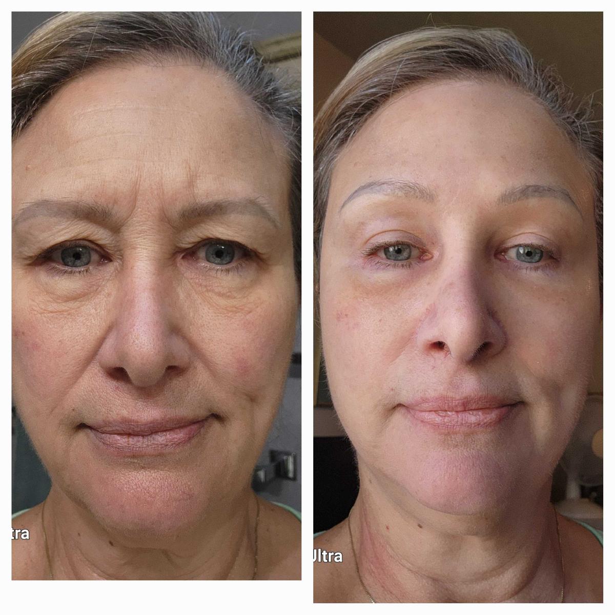 Instant FORM No-Filter Firming Primer, Tighten, Firm and Blur Skin for Flawless Makeup Application, Reduce Appearance of Fine Lines